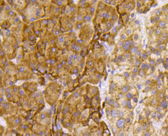 TSC2/Tuberin Antibody