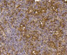 IGF2R/M6PR Antibody