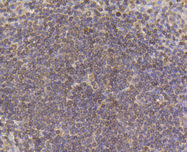 PDGF Receptor beta Antibody