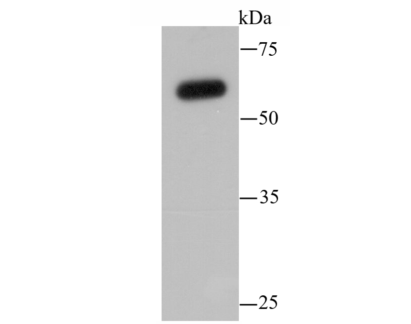 SHP(PTPN6) Antibody