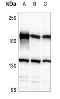Her2/ErbB2 Antibody