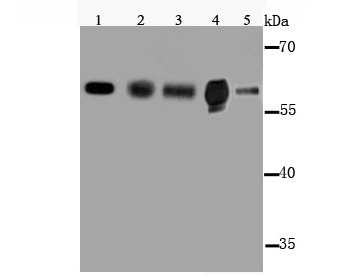 Cytochrome P450 2E1 Antibody