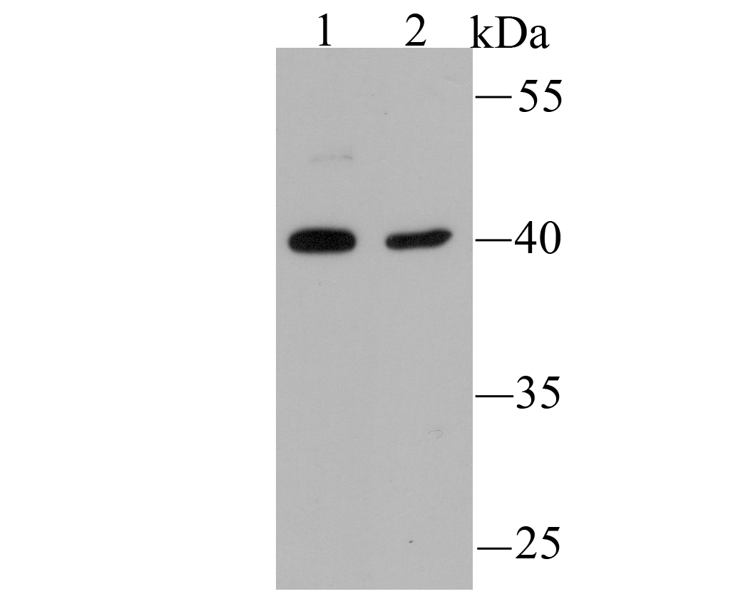 NSUN4 Antibody
