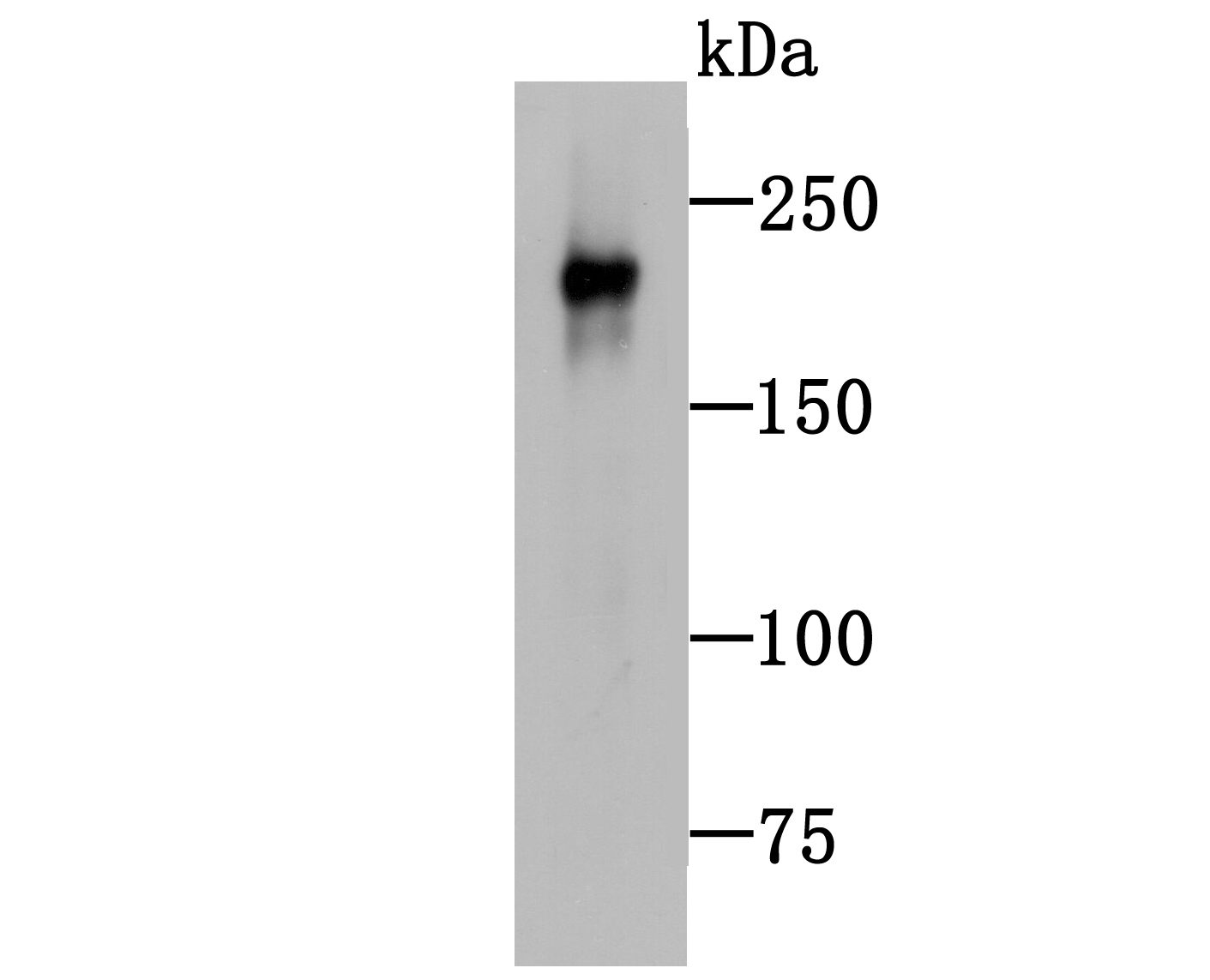 Neurofilament Antibody