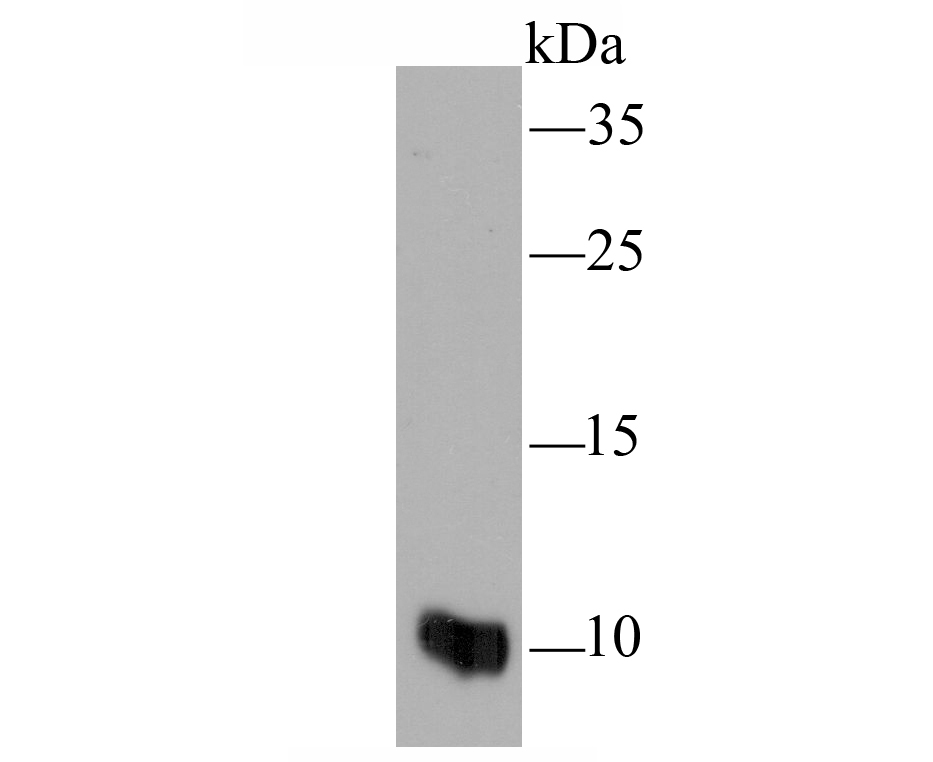 MRP8/S100A8 Antibody