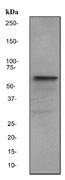 Estrogen Receptor alpha Antibody