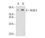 ALAS2 Antibody