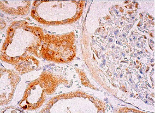 TIMP-2 Antibody