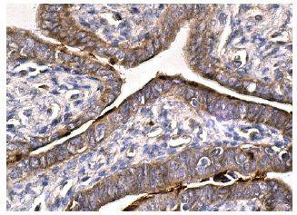 VEGFR Antibody