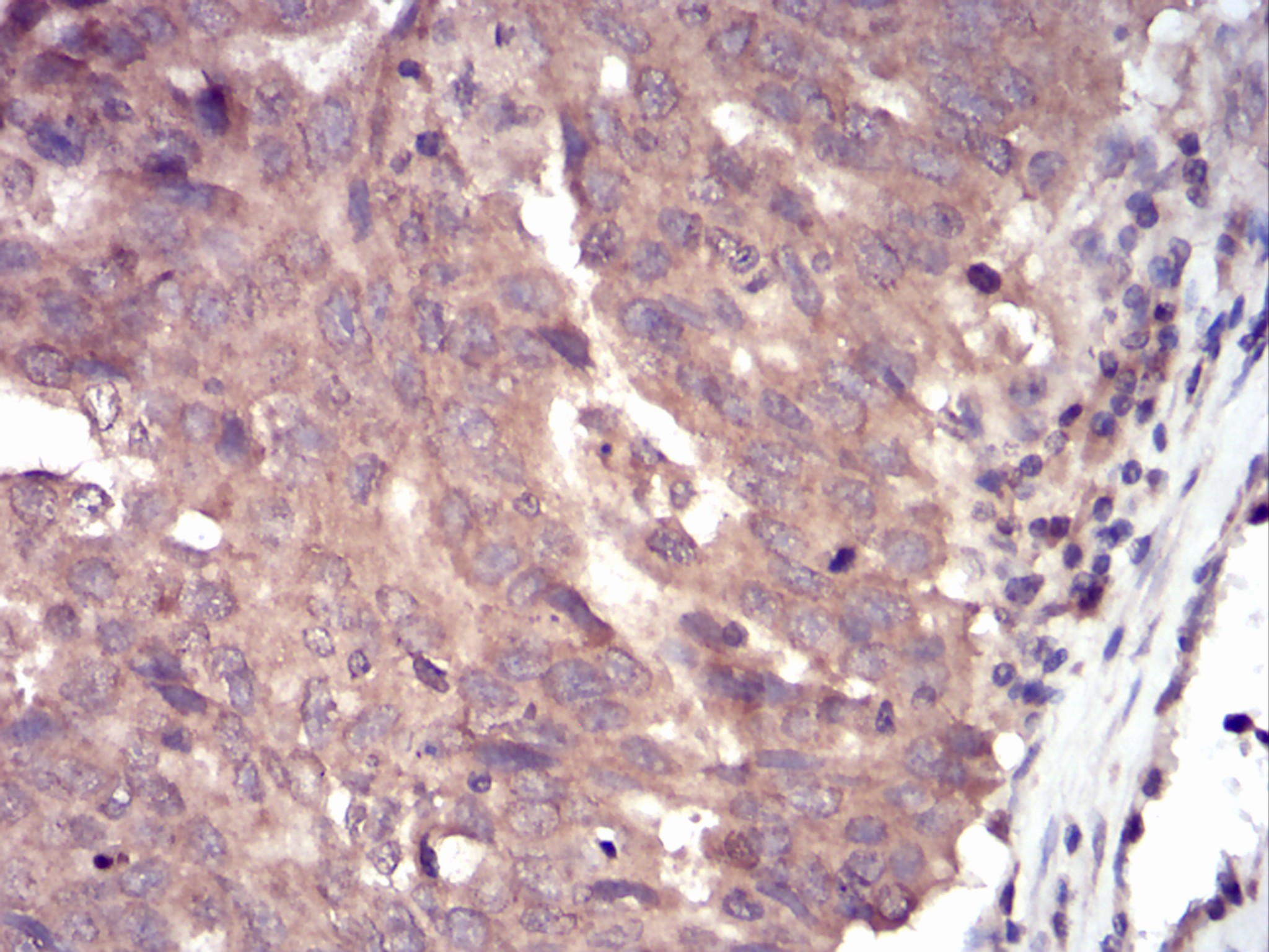 SLINGSHOTL Antibody