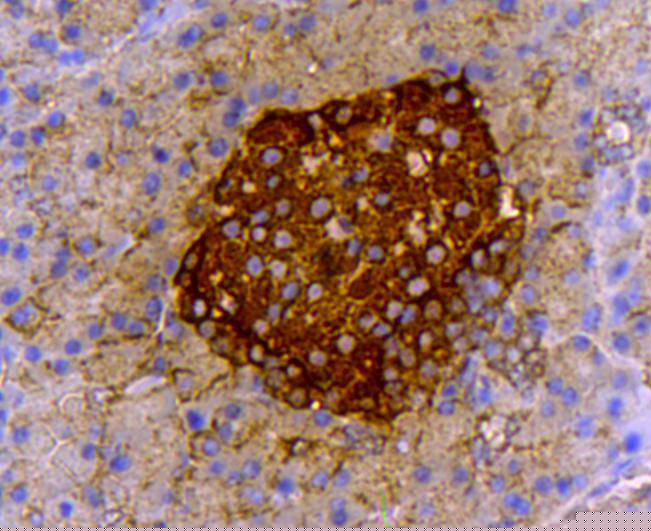 Insulin Antibody