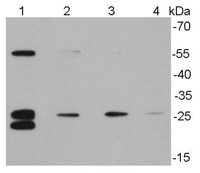 Bcl-2 Antibody