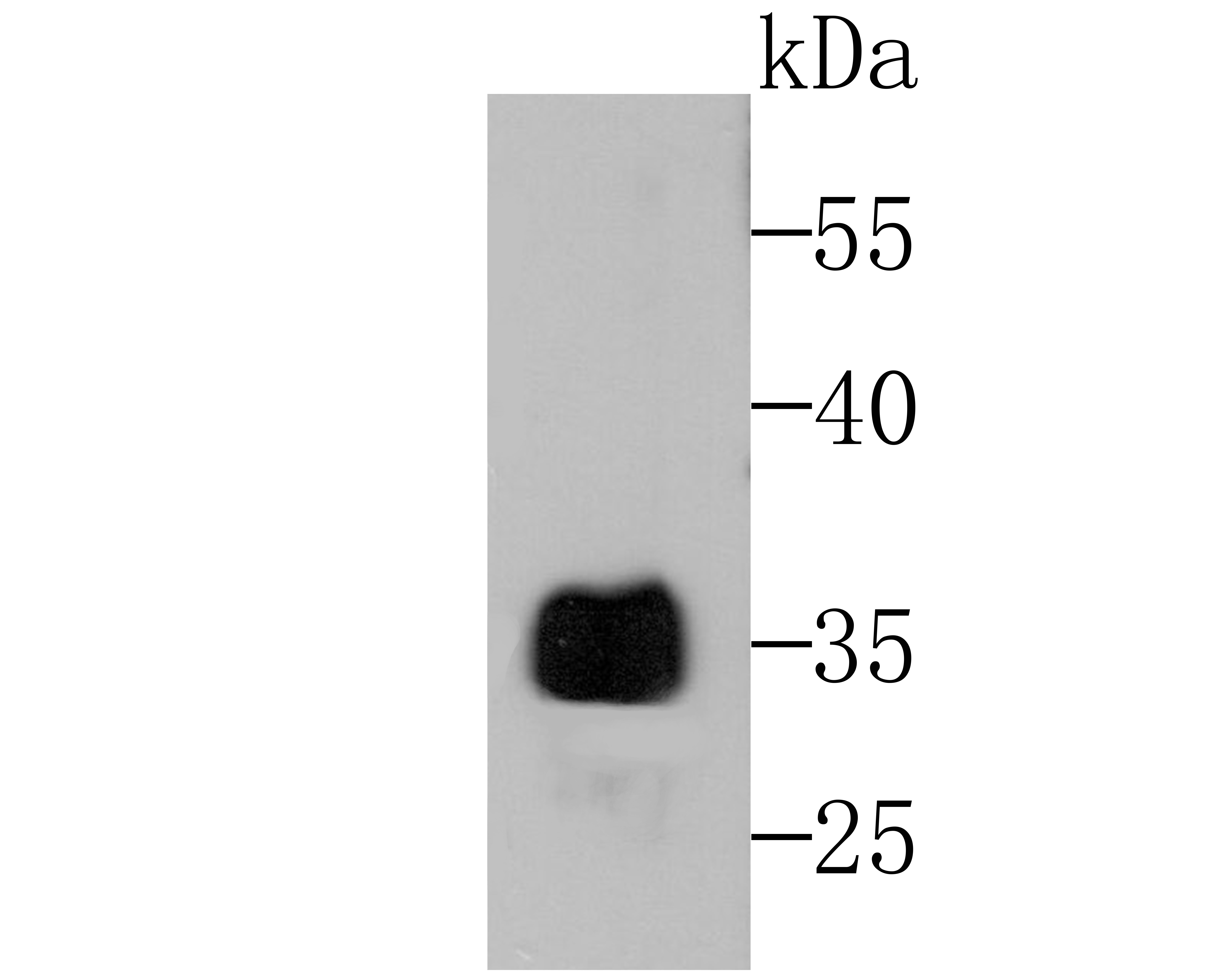 Alpha acid glycoprotein Antibody