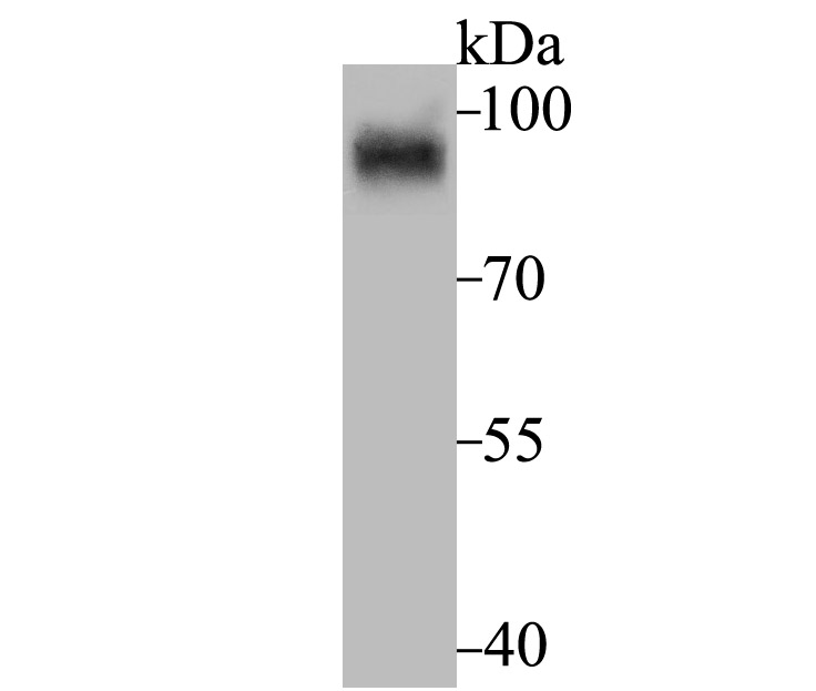 HIF1 alpha Antibody