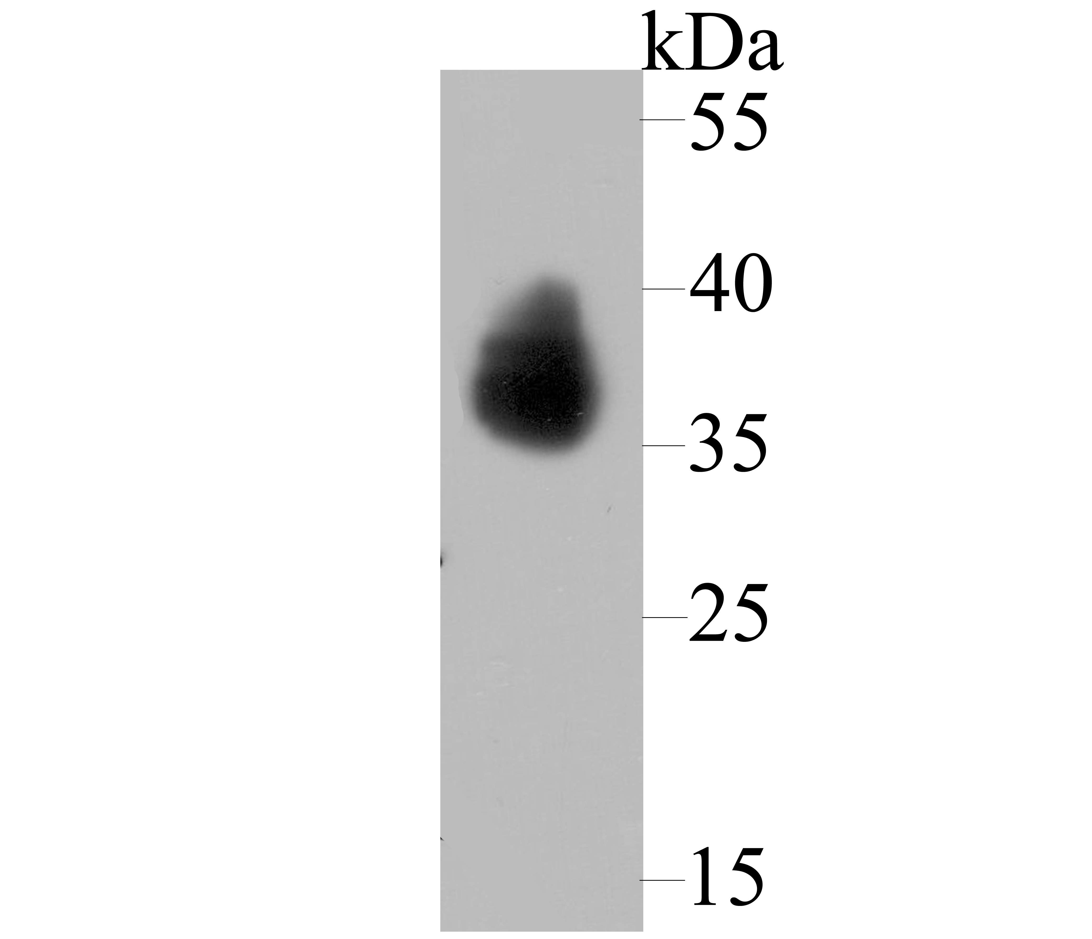 TROP2 Antibody