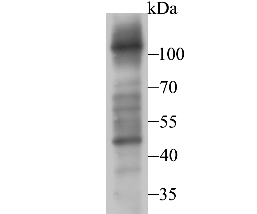 FBXL18 Antibody