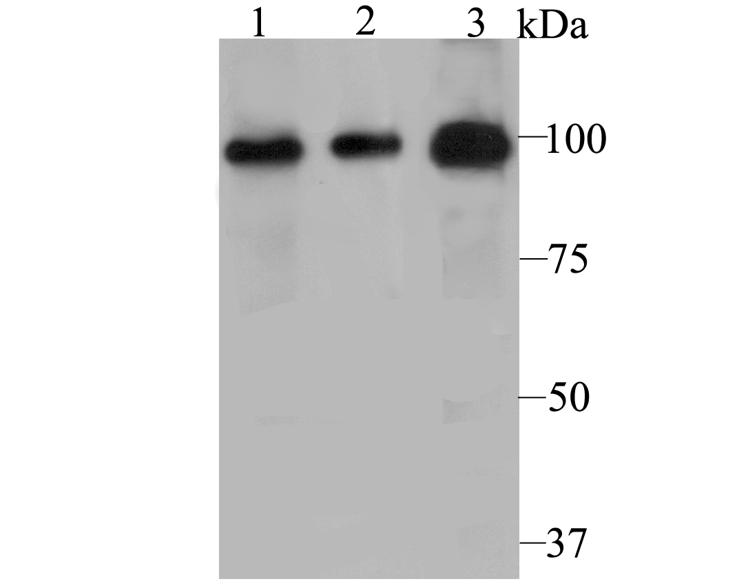 PHF8 Antibody