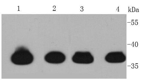 Cardiac Troponin /TTNNT2 Antibody