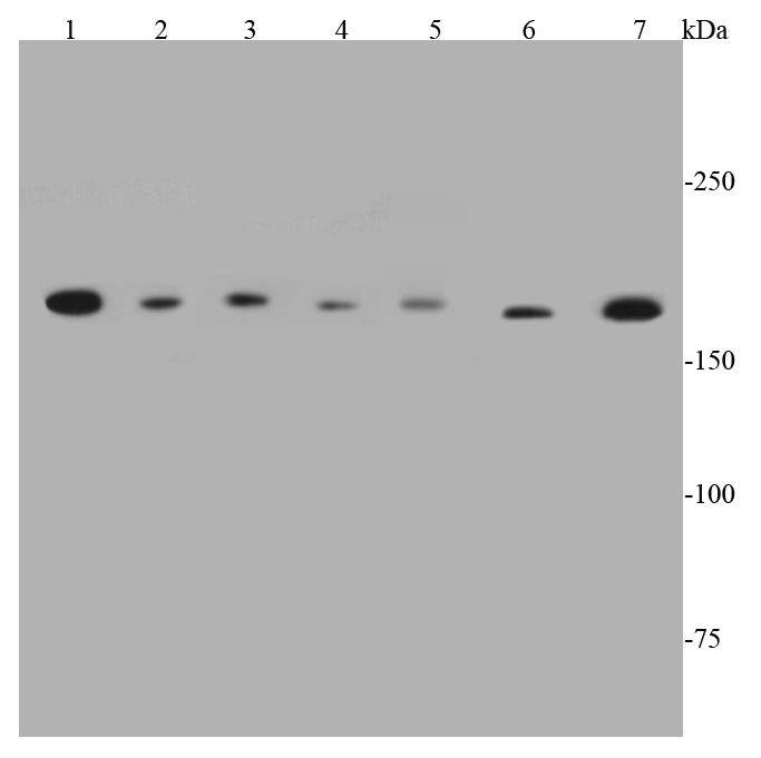 Topoisomerase II alpha Antibody