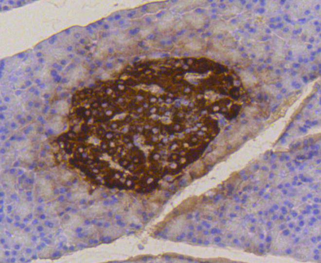 Insulin Antibody