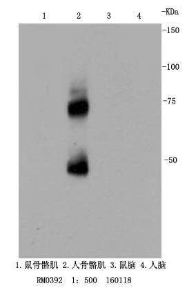 p75 NGF Receptor Antibody