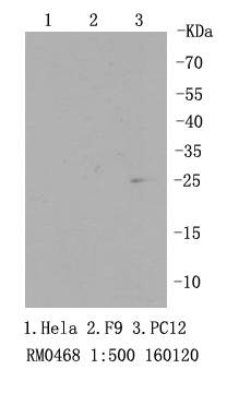 RPS3 Antibody