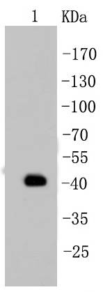 Cytokeratin 19 Antibody