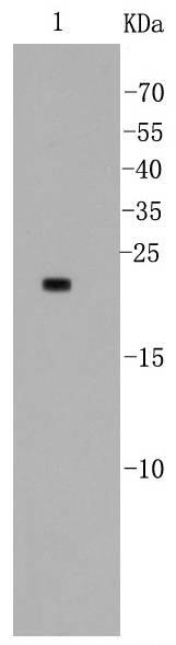 Bad Antibody