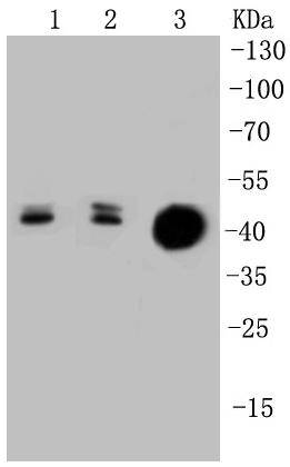 Cytokeratin 20 Antibody