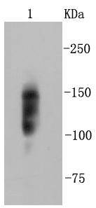 Integrin beta Antibody