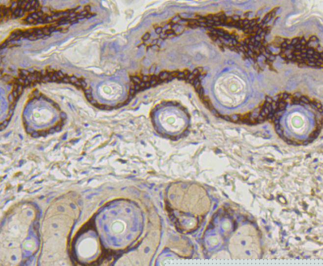Collagen XVII Antibody