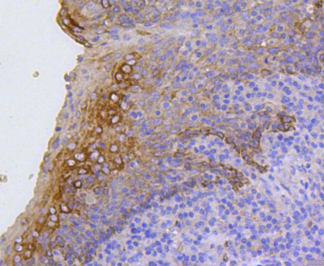 Cytokeratin 17 Antibody