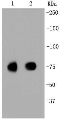 Scavenging Receptor SR-BI Antibody