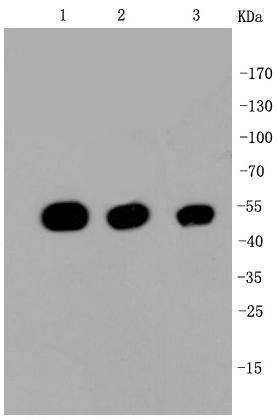 beta Tubulin Antibody