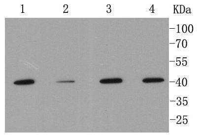 MMP12 Antibody