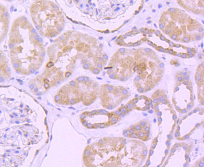 Bcl-2 Antibody