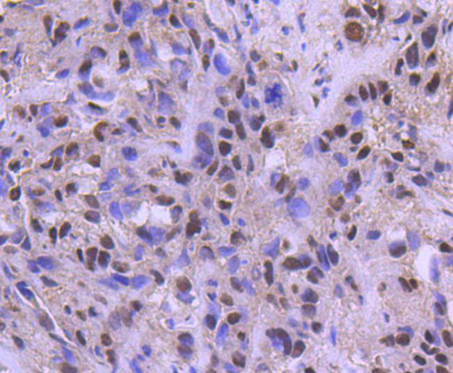 ATF2 Antibody