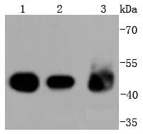 Cytokeratin 18 Antibody