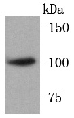 SATB1 Antibody