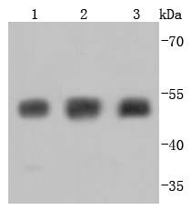 Tubulin beta-III Antibody