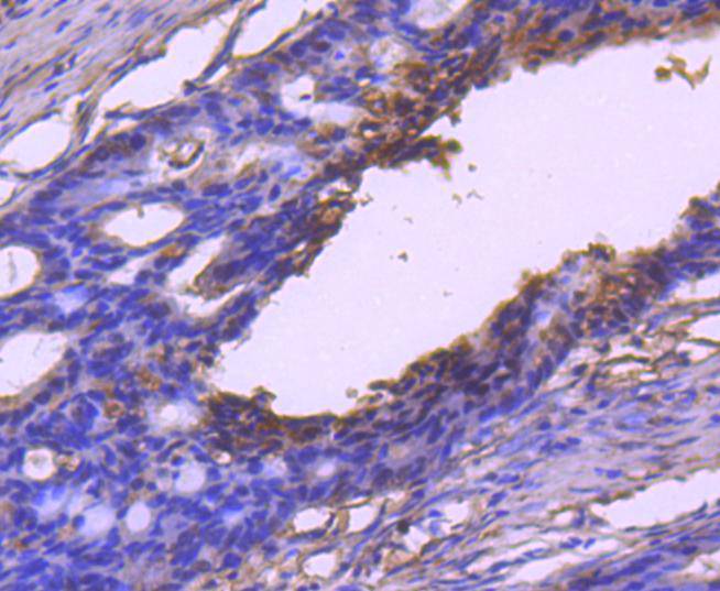 VEGF Antibody