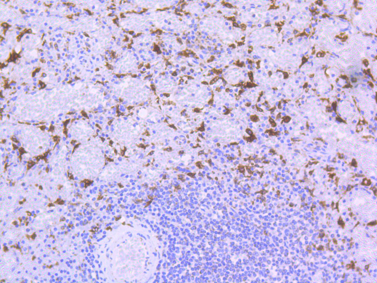 Heme Oxygenase 1(HO) Antibody