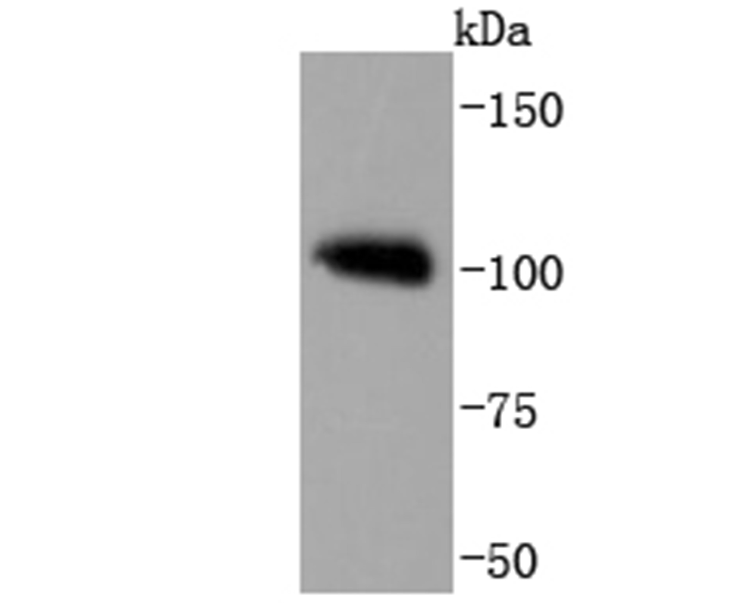 PMS2 Antibody