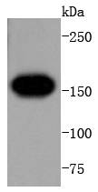 VEGF Receptor 1 Antibody