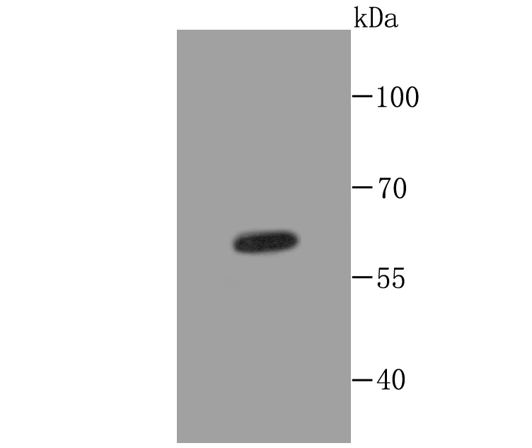 Cytokeratin 5 Antibody