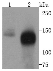 TACC3 Antibody