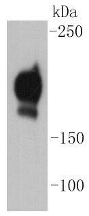 PDGF Receptor beta Antibody