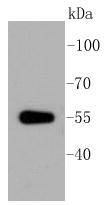 ALDH1A1 Antibody