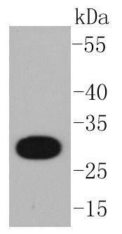 CD20 Antibody