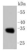 Calponin Antibody